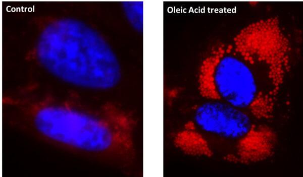 油酸处理的 HeLa 细胞（右）脂滴染色.jpg