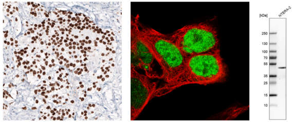 多能性胚胎干细胞是通过表达多种多能性标记物鉴定的.jpg